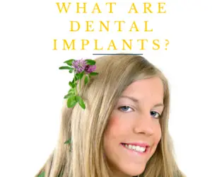 dentalimplants