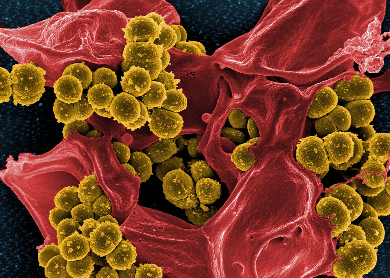 Bacteria Influence Brown Fat to Promote Weight Loss – Hail Akkermansia