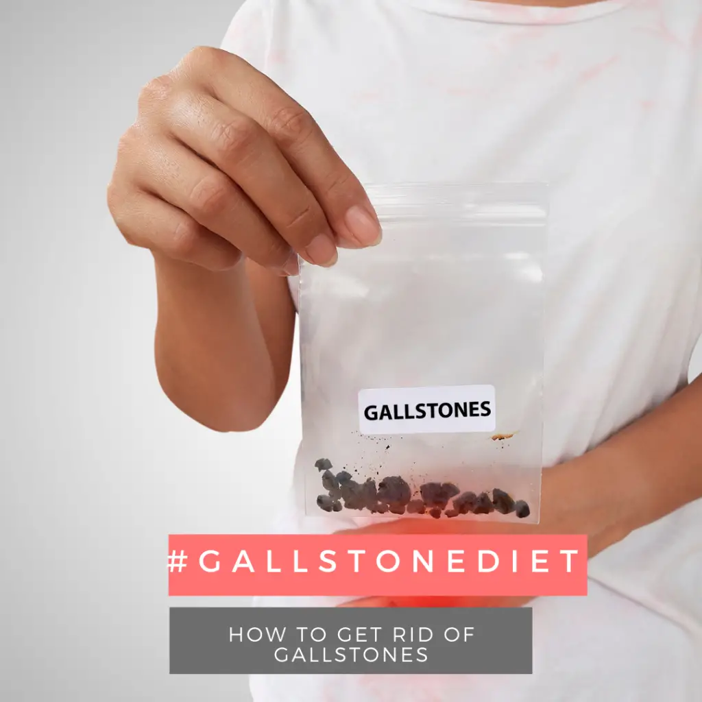 gallstone diet