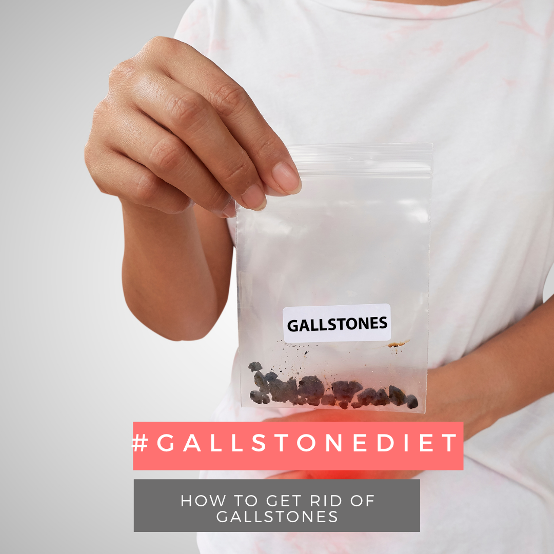 Gallstones Diet Foods That You Must Eat To Avert Gallstones