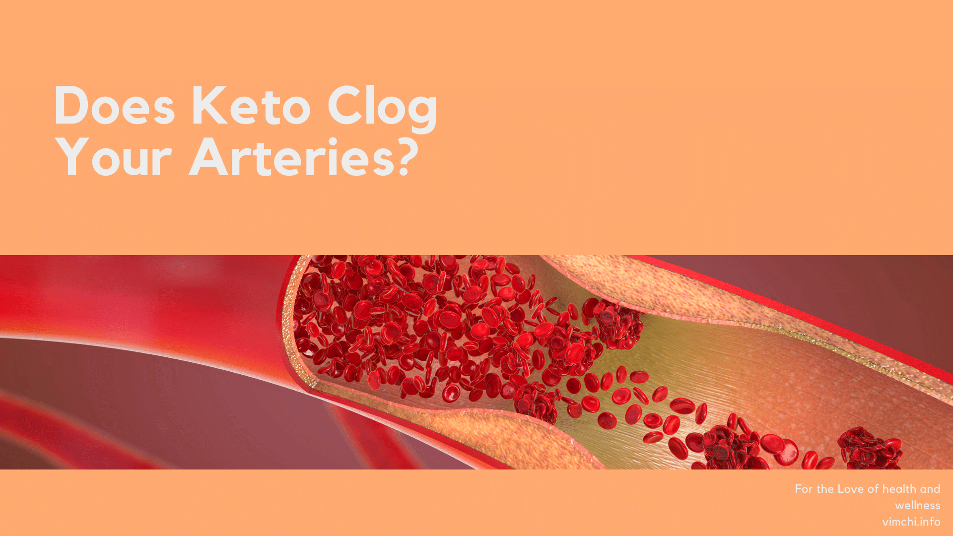 does keto clog arteries