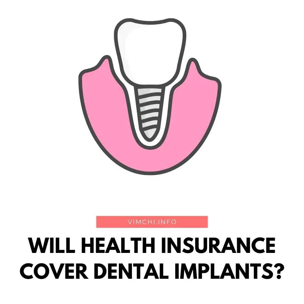 Will Health Insurance Cover Dental Implants featured