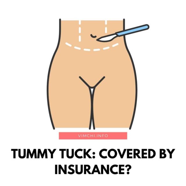 Many patients would want to know, “Will health insurance pay for a tummy tuck?” Keep reading to know more.
