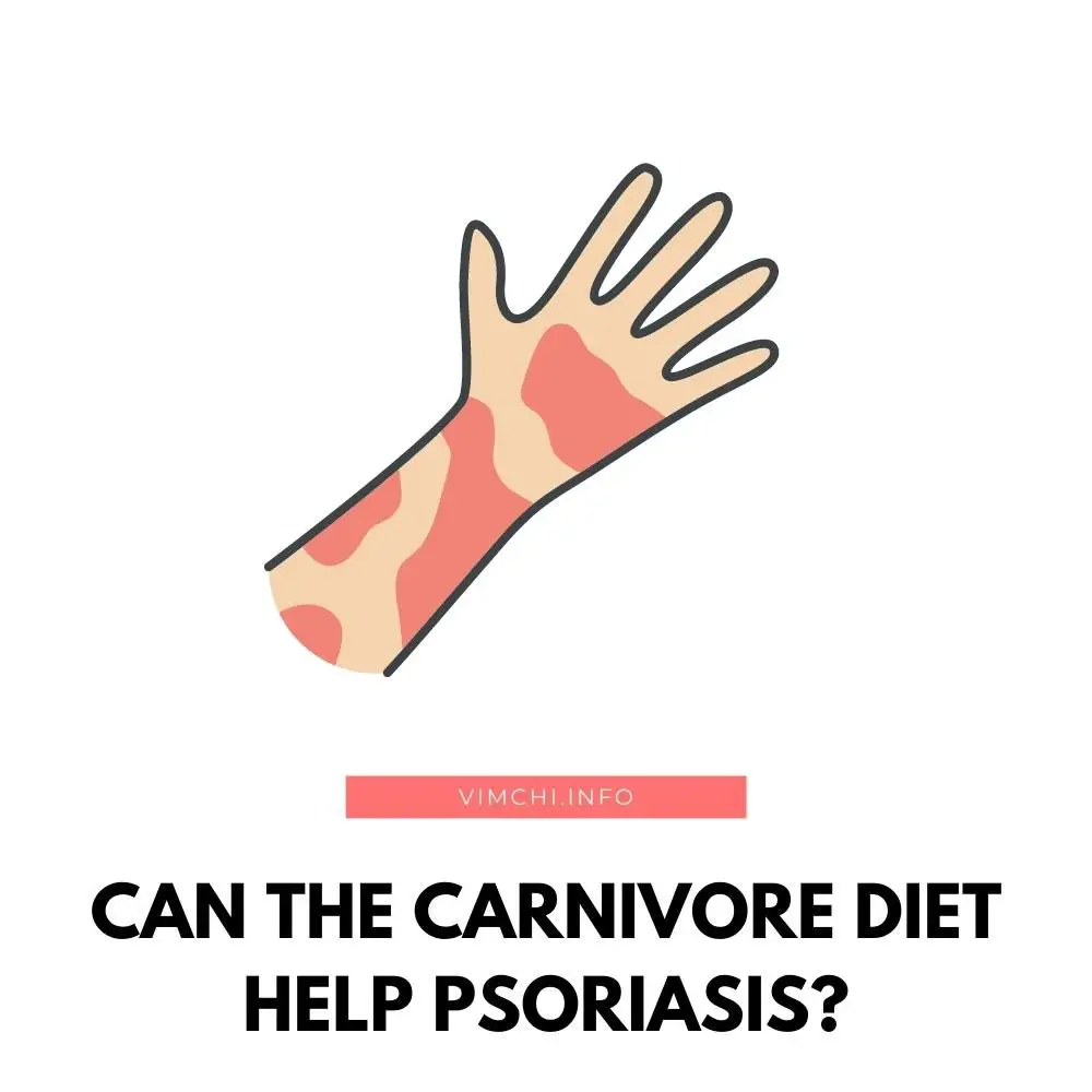 Can the Carnivore Diet Help Psoriasis featured