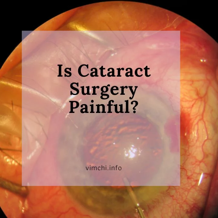 Is Cataract Surgery Painful featured