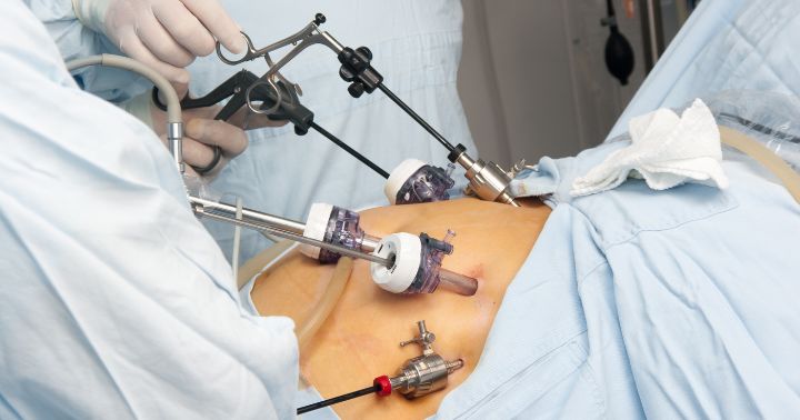 bariatric surgery insurance coverage